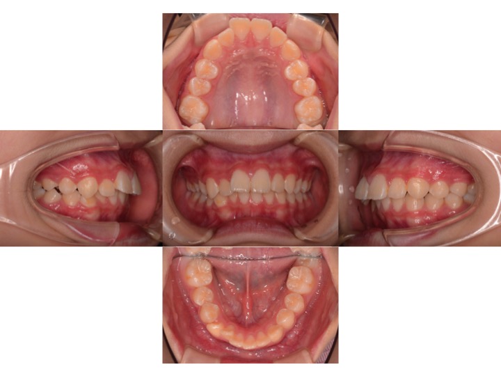 矯正治療の流れ②精密検査 | 稲沢市・一宮市で矯正治療なら稲沢矯正